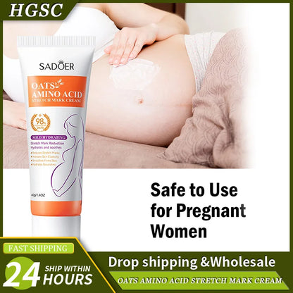 Stretch Mark Cream