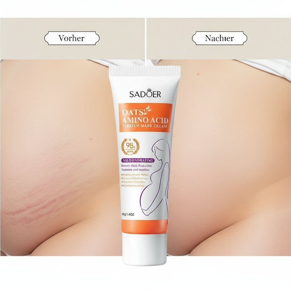 Stretch Mark Cream