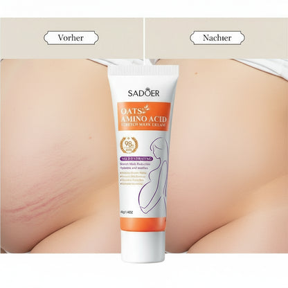 Stretch Mark Cream
